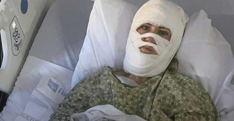 Ashley Wasielewski in hospital bed after acid attack in Savannah park